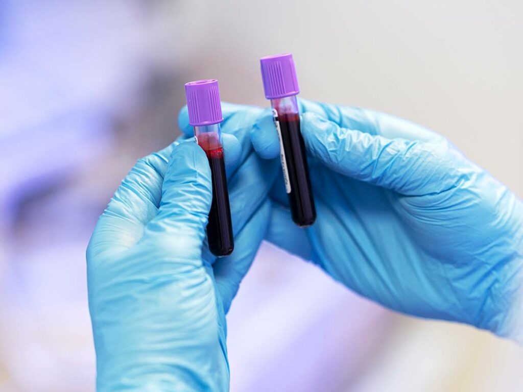 politica-26-06-ft-freepik-exame-sangue