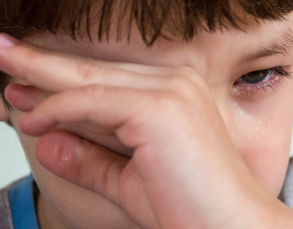 saude-05-06-ft-LDC-Comunicacao-crianca-cocando-olho