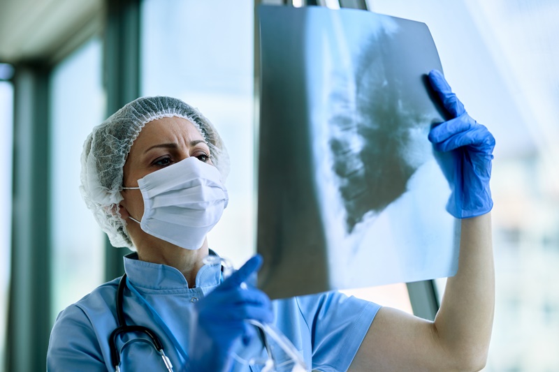 Female doctor examining patient's chest X-ray at the hospital. Female radiologist analyzing chest X-ray of an patient at medical clinic during coronavirus epidemic.