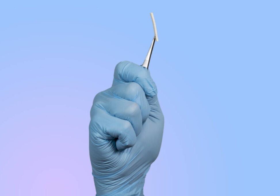 Hormonal implant or beauty chip is a subcutaneous application.