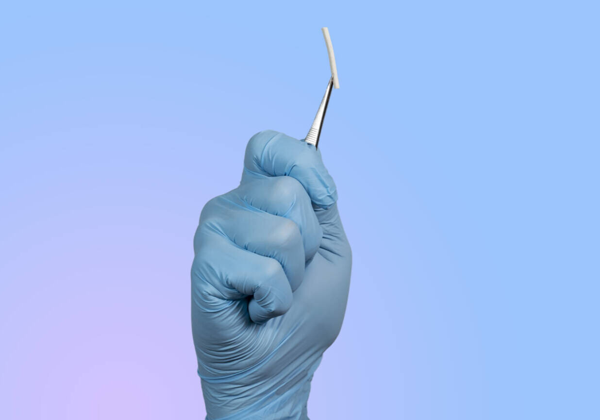 Hormonal implant or beauty chip is a subcutaneous application.